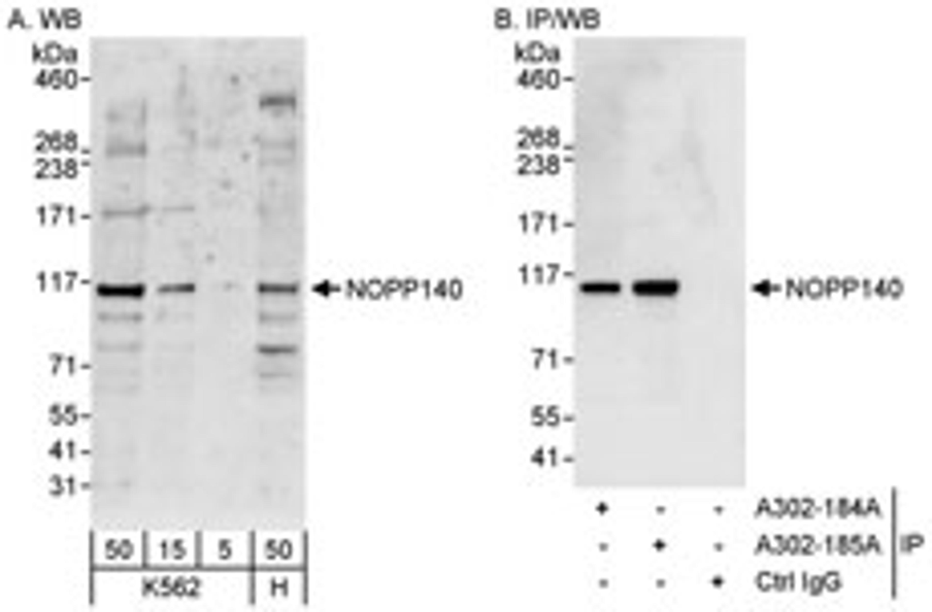 Detection of human NOPP140 by western blot and immunoprecipitation.