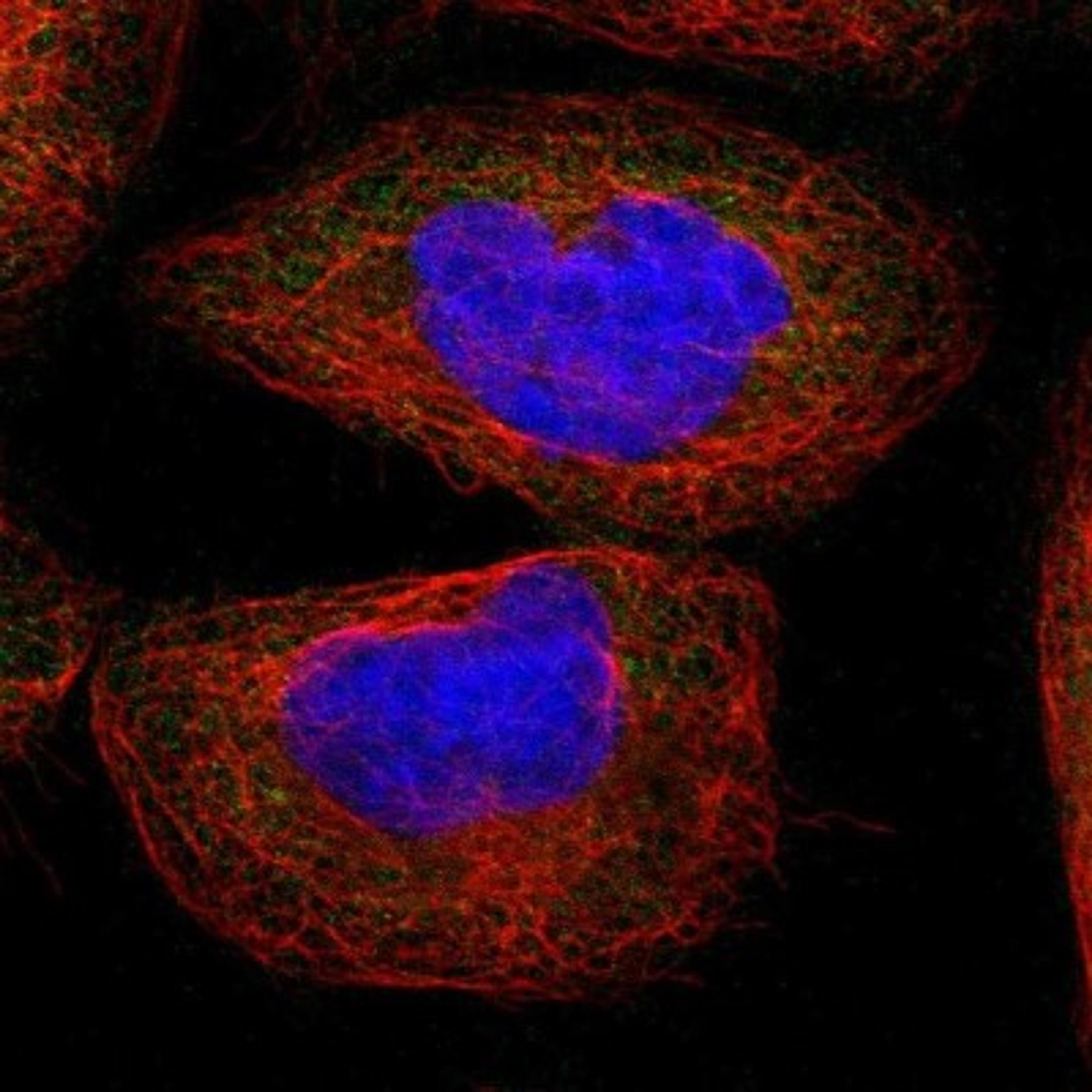 Immunocytochemistry/Immunofluorescence: SAMD4B Antibody [NBP1-94045] - Staining of human cell line A-431 shows positivity in cytoplasm.