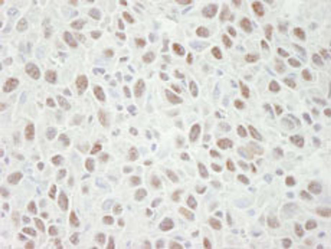 Detection of mouse MCM4 by immunohistochemistry.