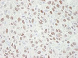 Detection of mouse MCM4 by immunohistochemistry.