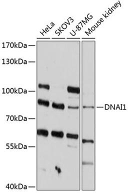 Western blot - DNAI1 antibody (A12130)