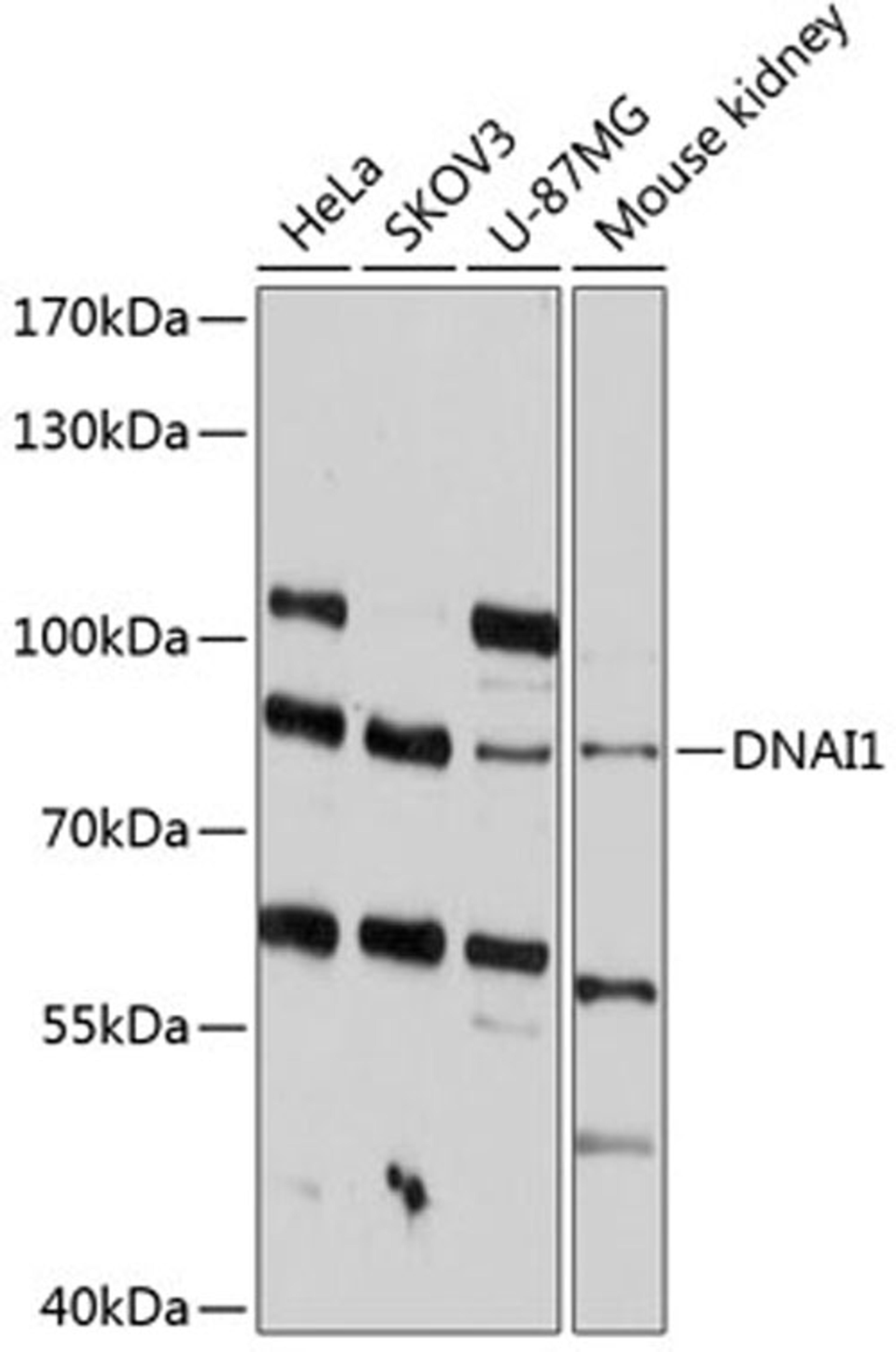 Western blot - DNAI1 antibody (A12130)