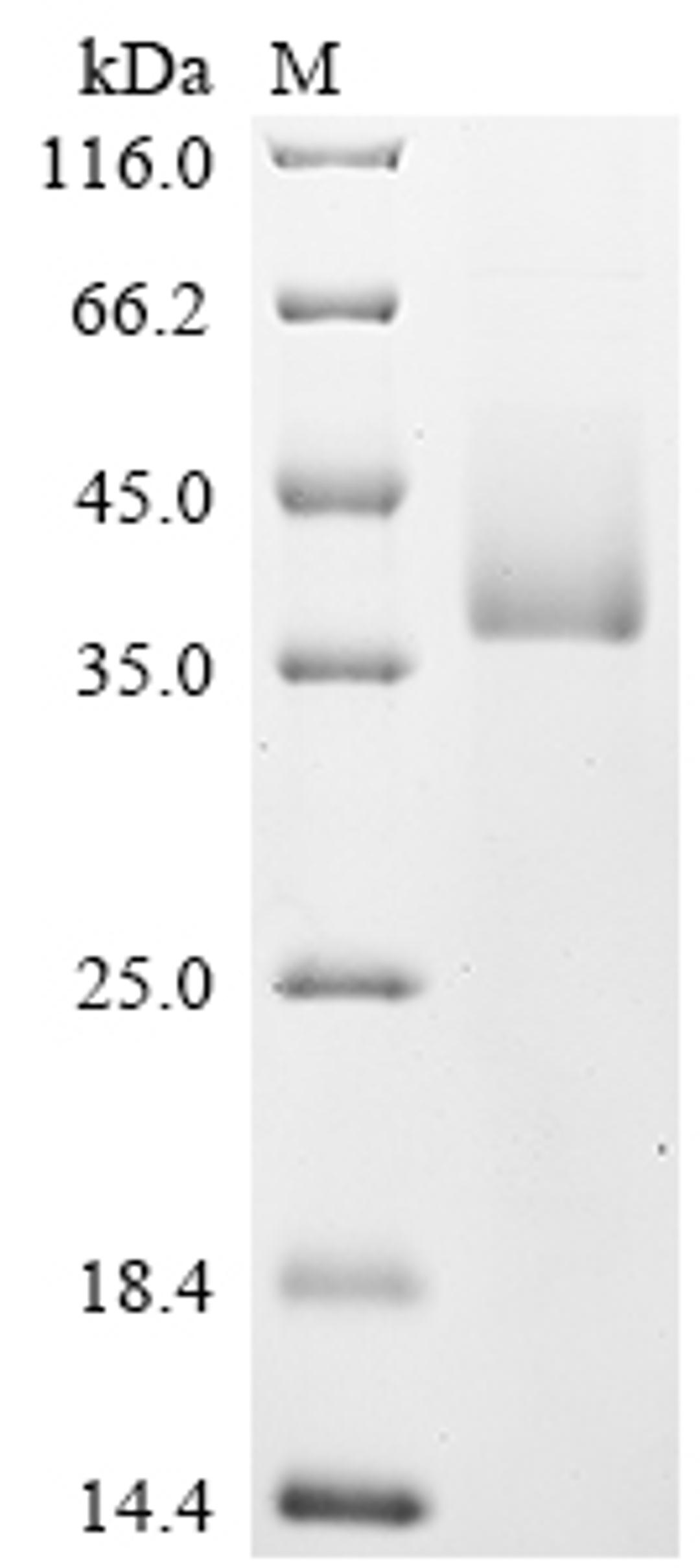 (Tris-Glycine gel) Discontinuous SDS-PAGE (reduced) with 5% enrichment gel and 15% separation gel.
