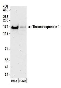 Detection of human and mouse Thrombospondin 1 by western blot.