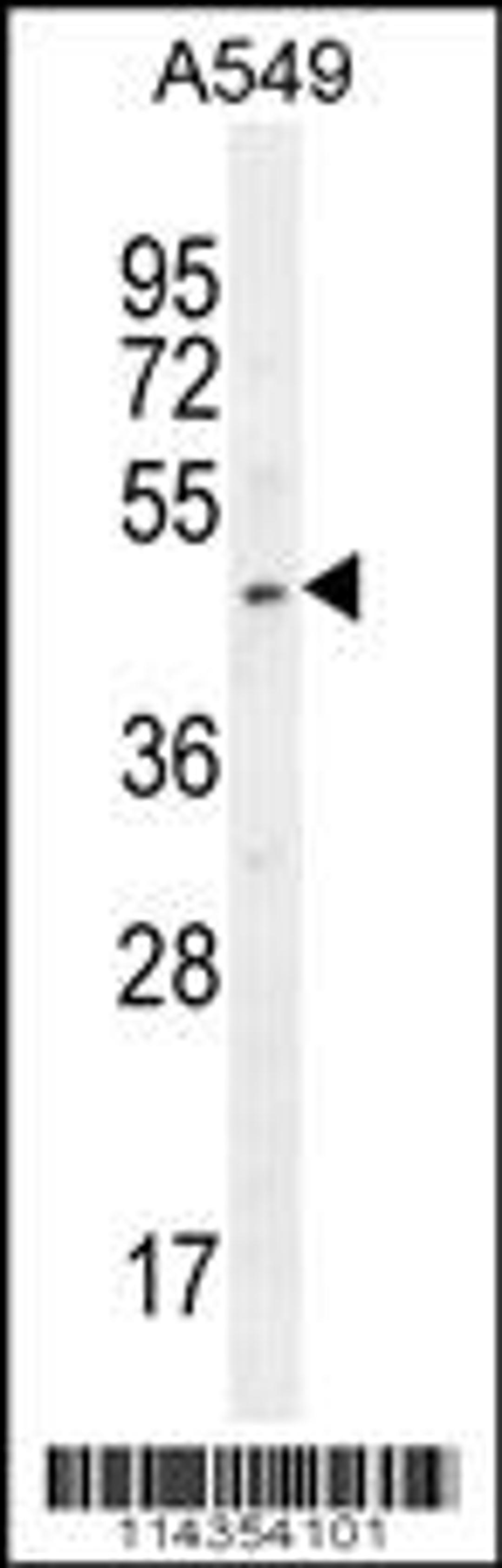 Western blot analysis in A549 cell line lysates (35ug/lane).This demonstrates the SOX3 antibody detected the SOX3 protein (arrow).