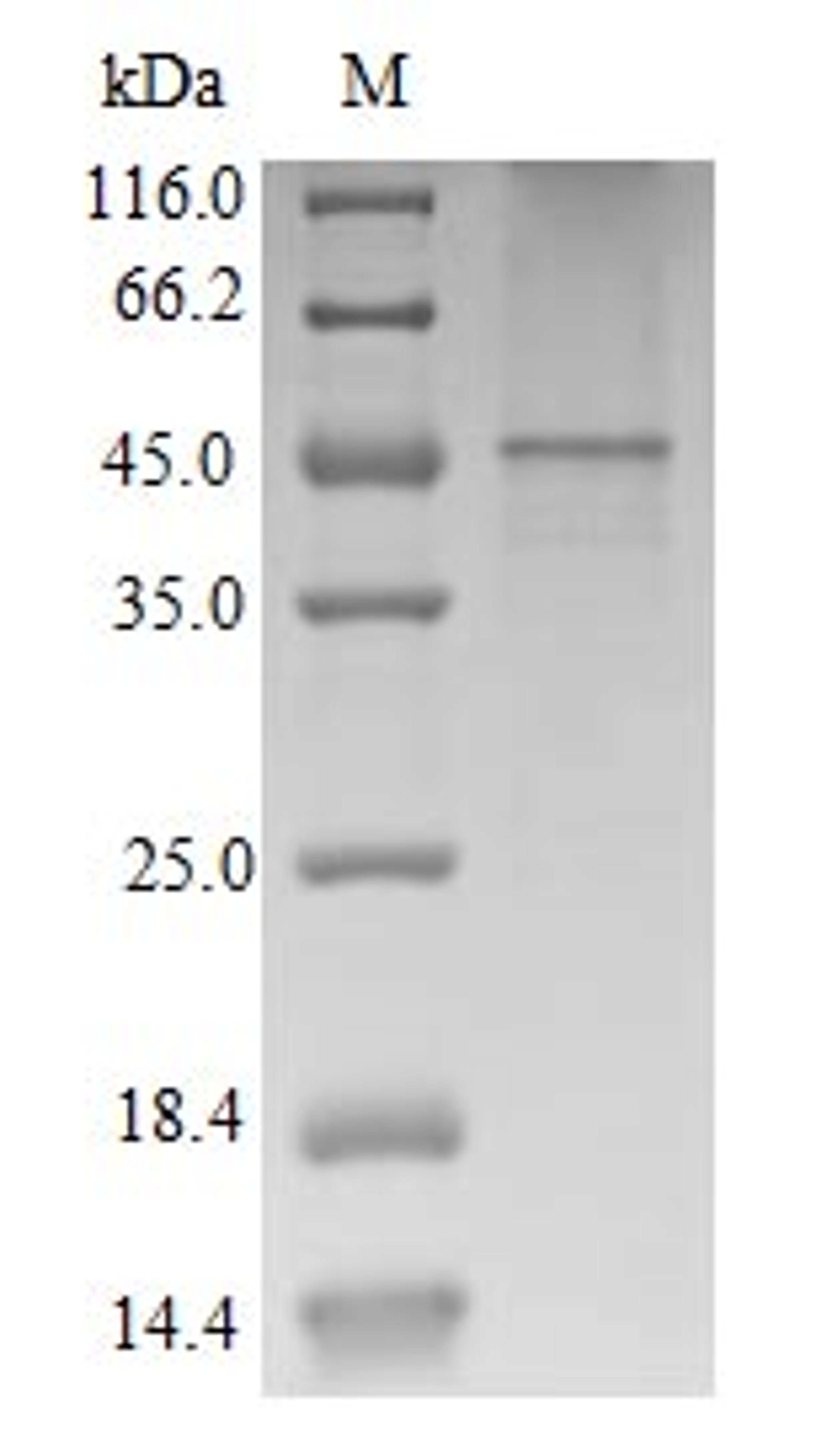 (Tris-Glycine gel) Discontinuous SDS-PAGE (reduced) with 5% enrichment gel and 15% separation gel.