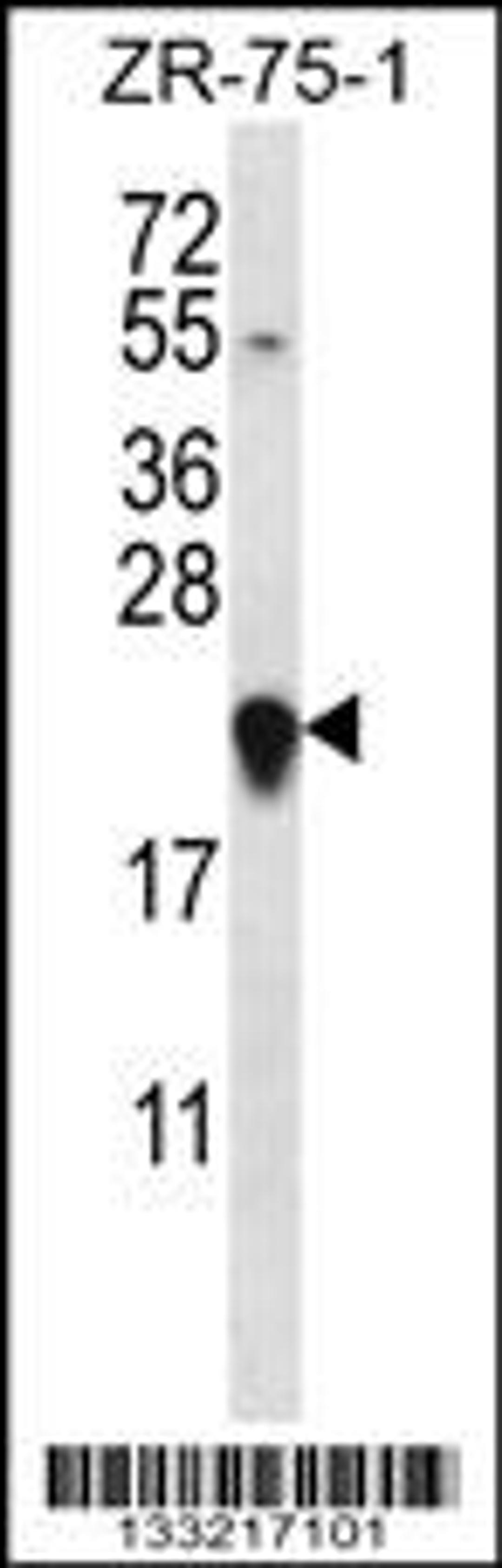 Western blot analysis in ZR-75-1 cell line lysates (35ug/lane).