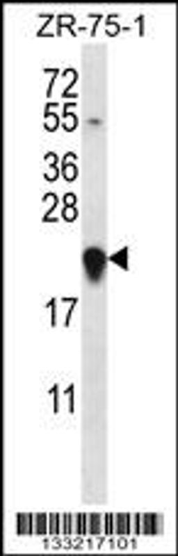 Western blot analysis in ZR-75-1 cell line lysates (35ug/lane).