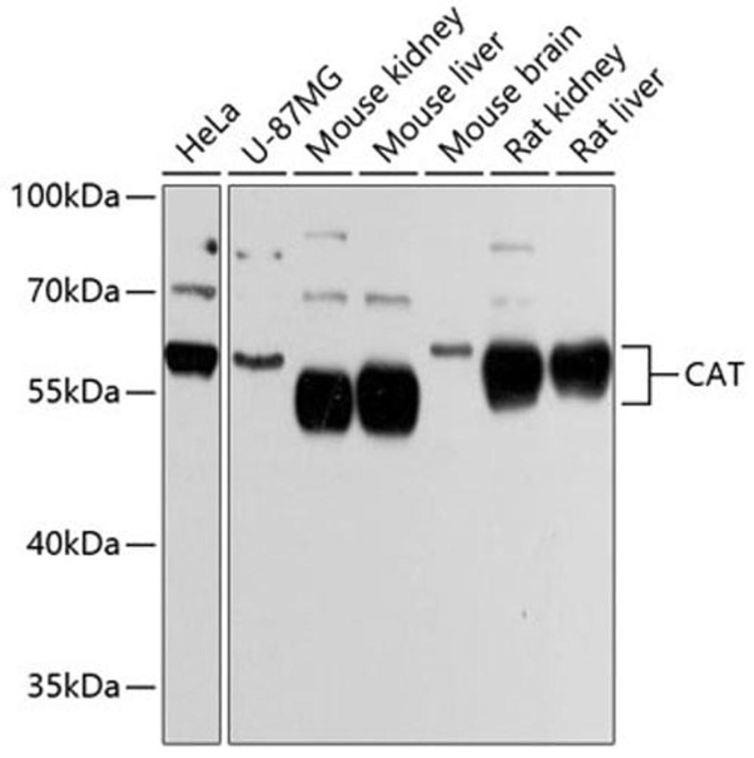 Western blot - CAT Antibody (A11777)