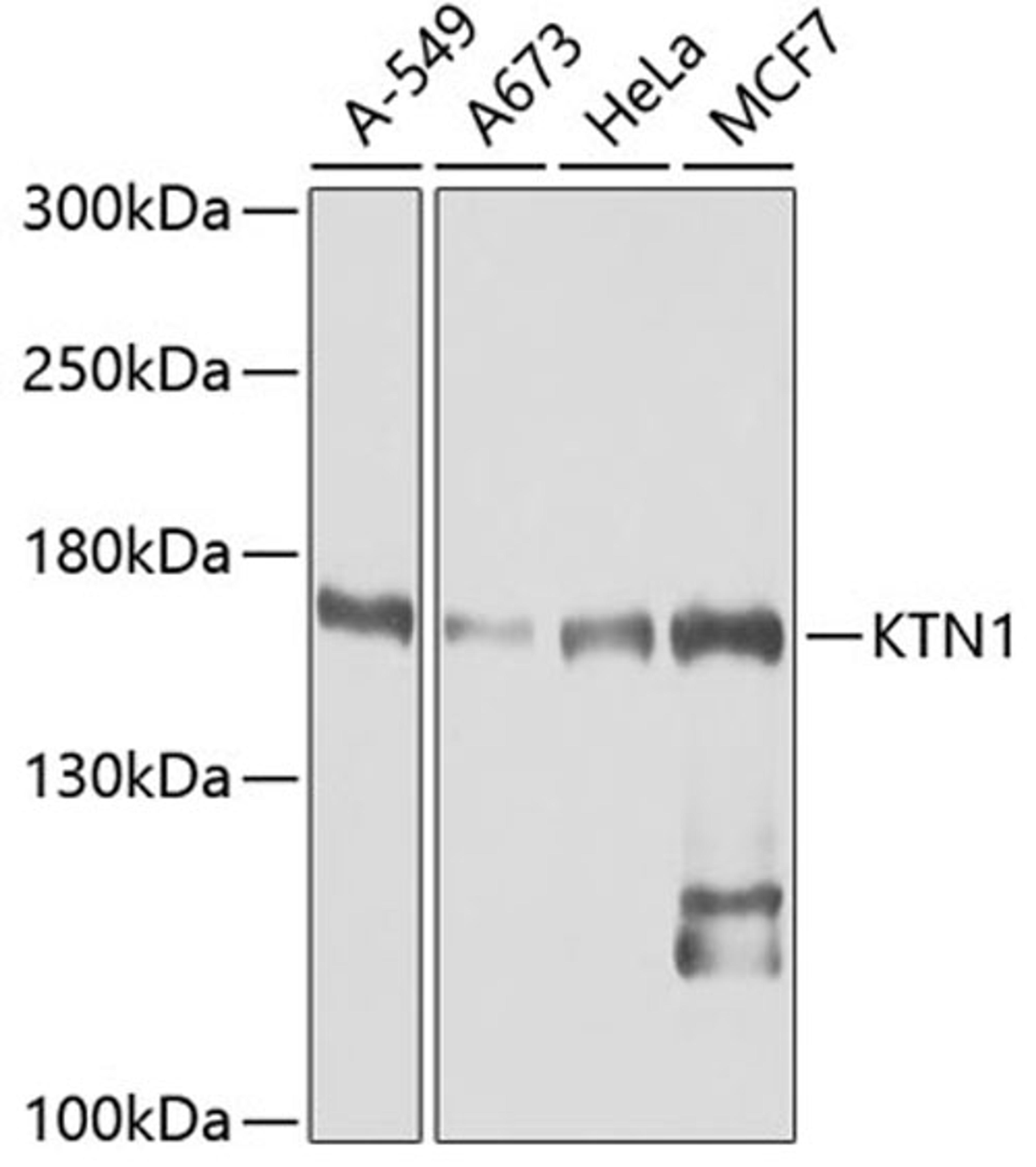 Western blot - KTN1 antibody (A5879)