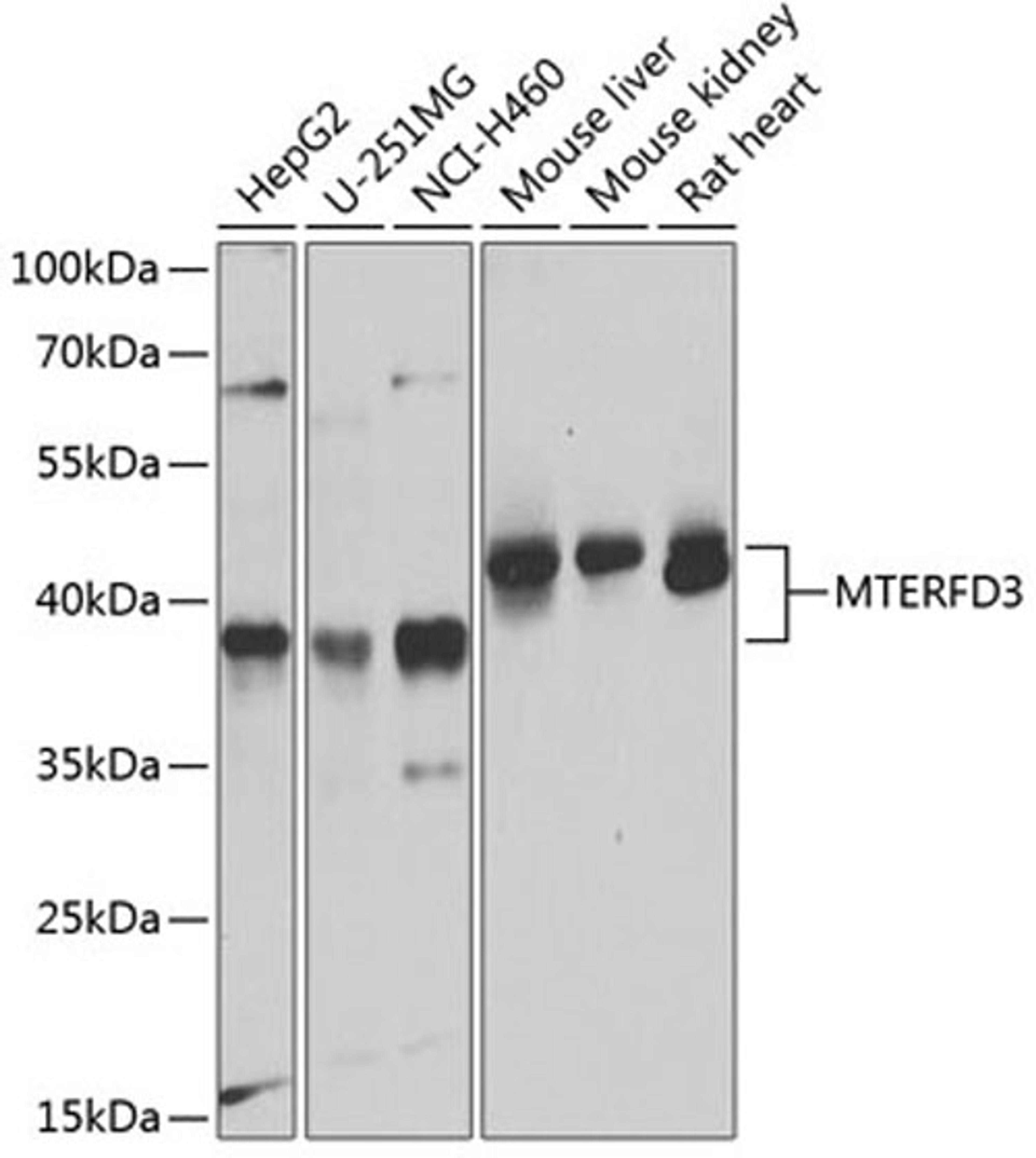 Western blot - MTERFD3 antibody (A8518)