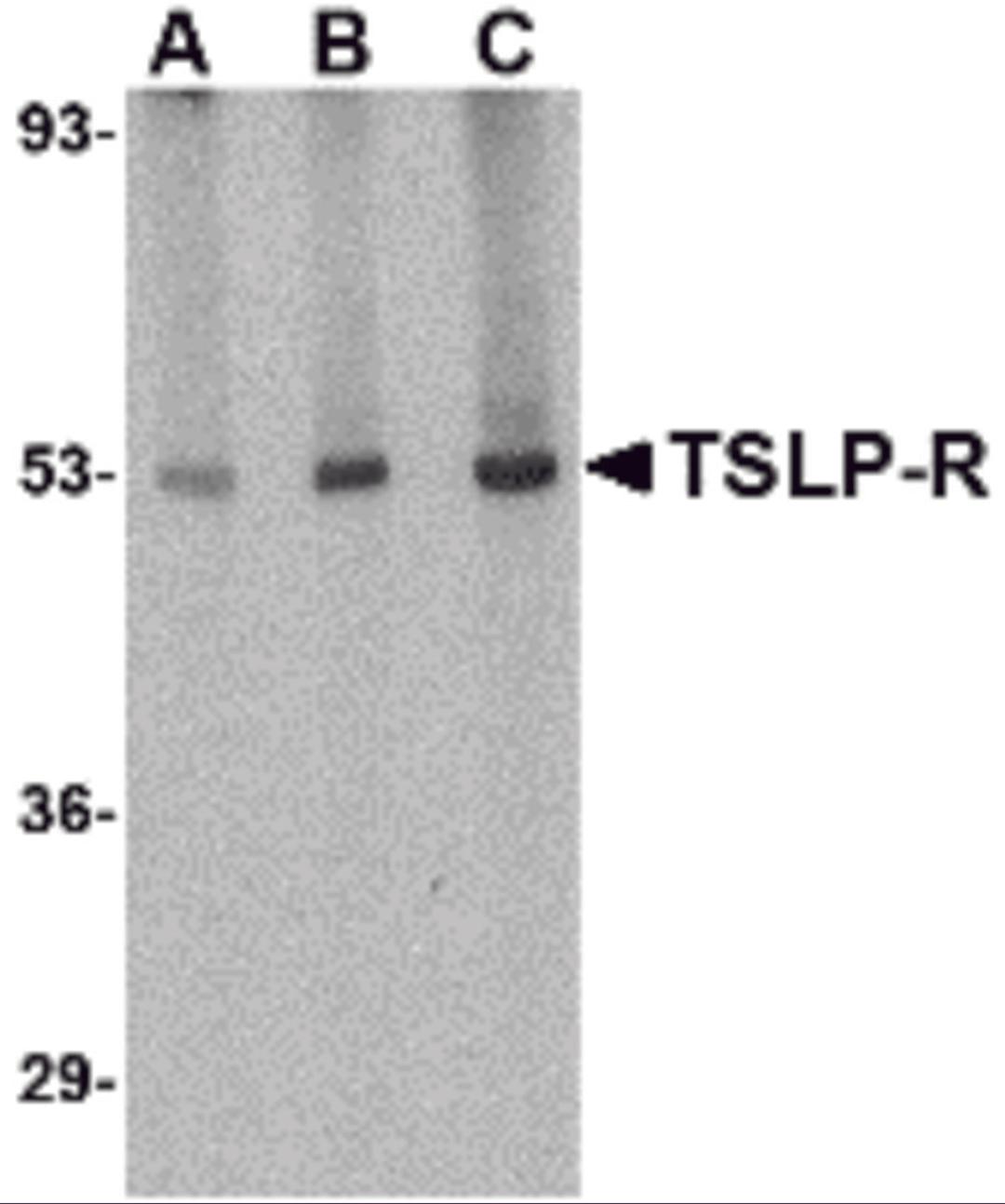 Western blot analysis of TSLP Receptor in human liver tissue lysate with TSLP Receptor antibody at (A) 0.5, (B) 1 and (C) 2 μg/mL.