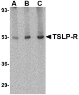 Western blot analysis of TSLP Receptor in human liver tissue lysate with TSLP Receptor antibody at (A) 0.5, (B) 1 and (C) 2 μg/mL.