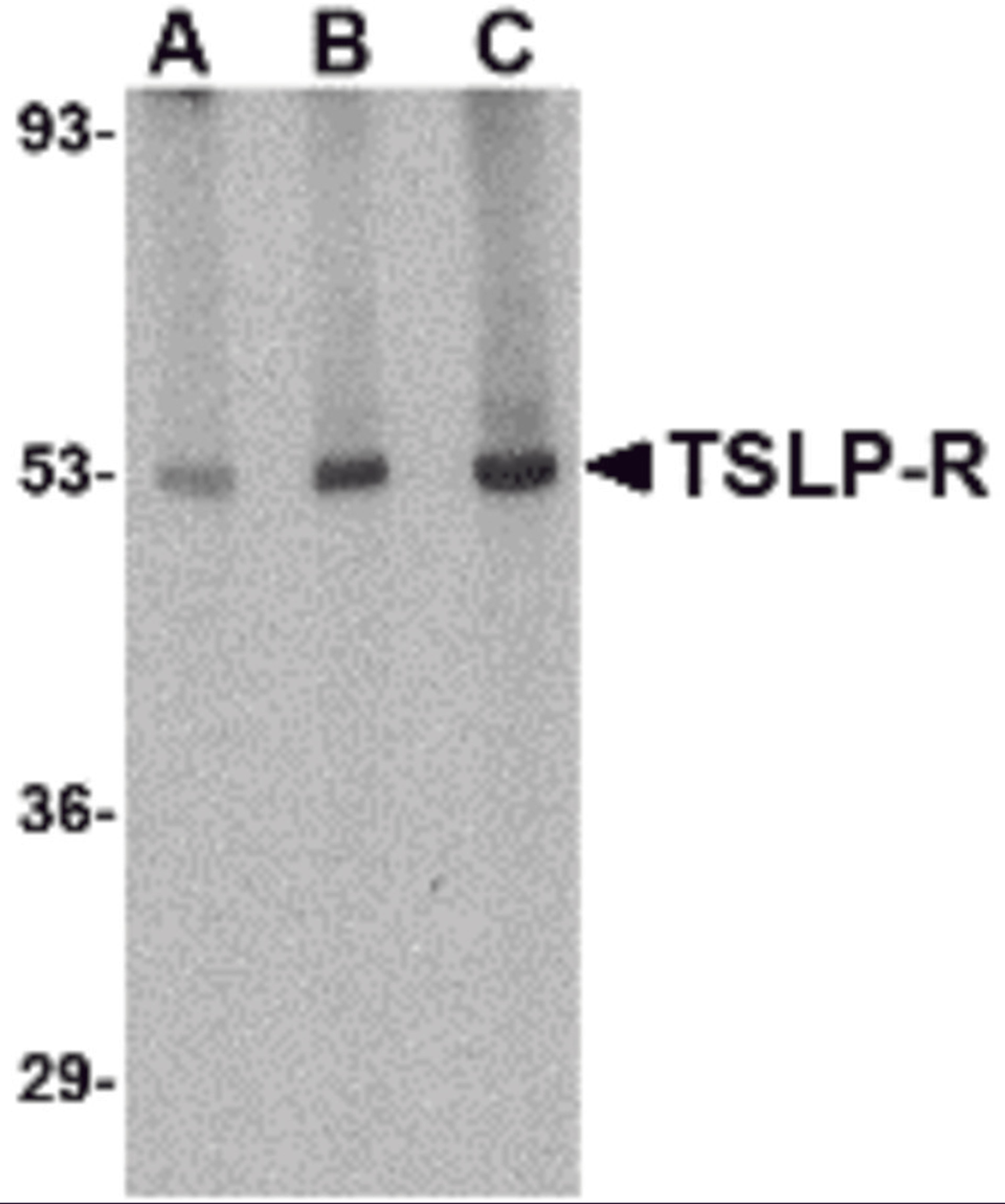 Western blot analysis of TSLP Receptor in human liver tissue lysate with TSLP Receptor antibody at (A) 0.5, (B) 1 and (C) 2 μg/mL.