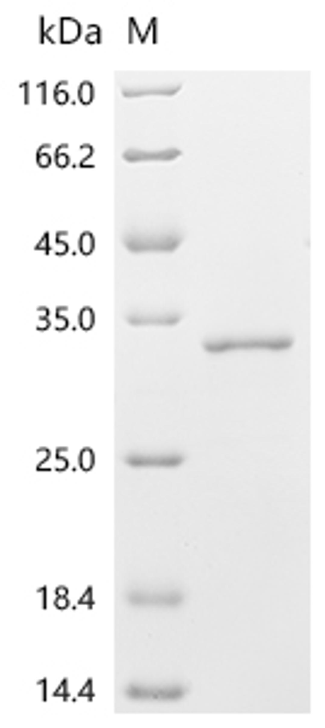 (Tris-Glycine gel) Discontinuous SDS-PAGE (reduced) with 5% enrichment gel and 15% separation gel.