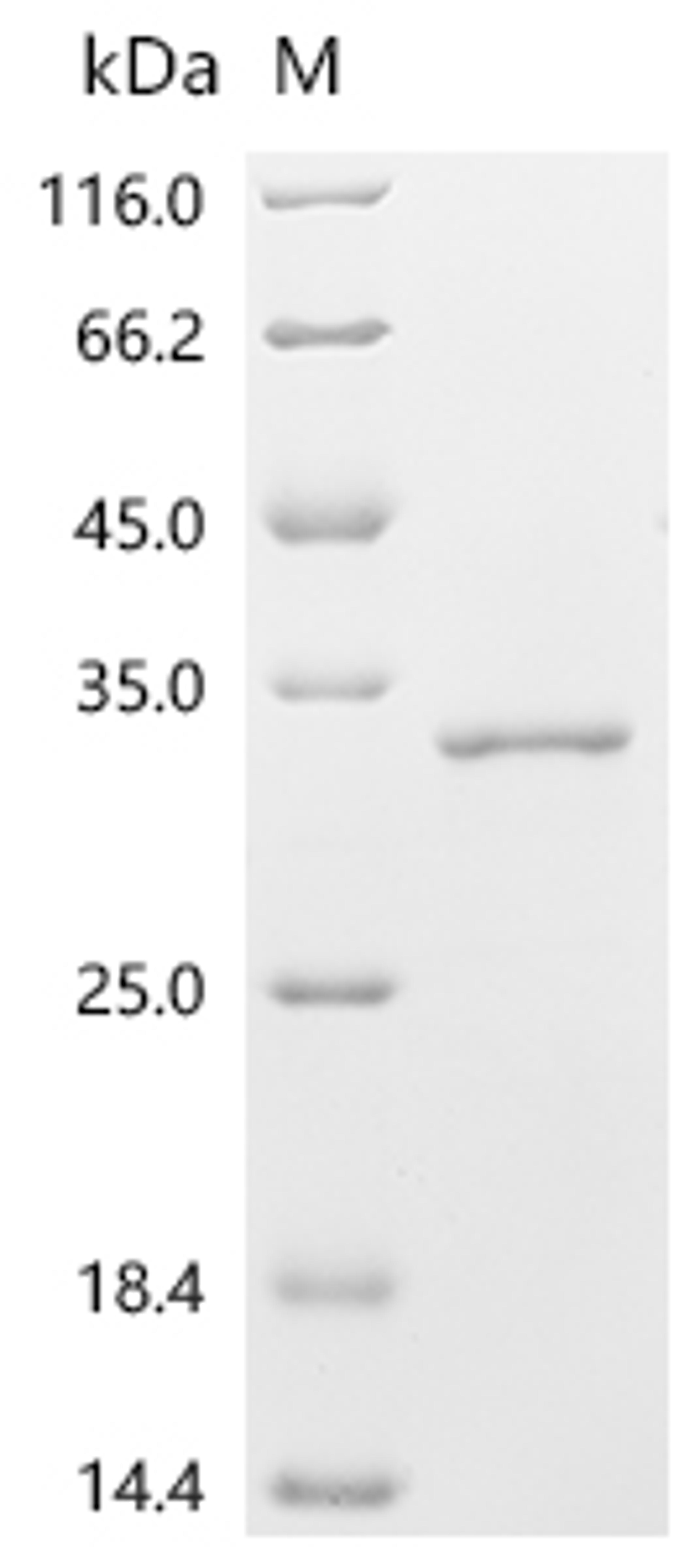 (Tris-Glycine gel) Discontinuous SDS-PAGE (reduced) with 5% enrichment gel and 15% separation gel.