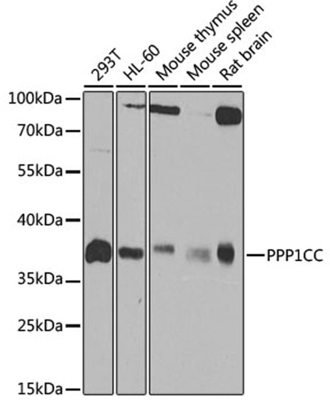 Western blot - PPP1CC antibody (A4035)