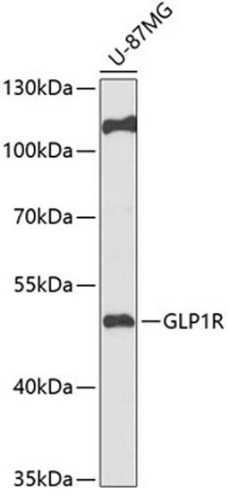 Western blot - GLP1R antibody (A13990)