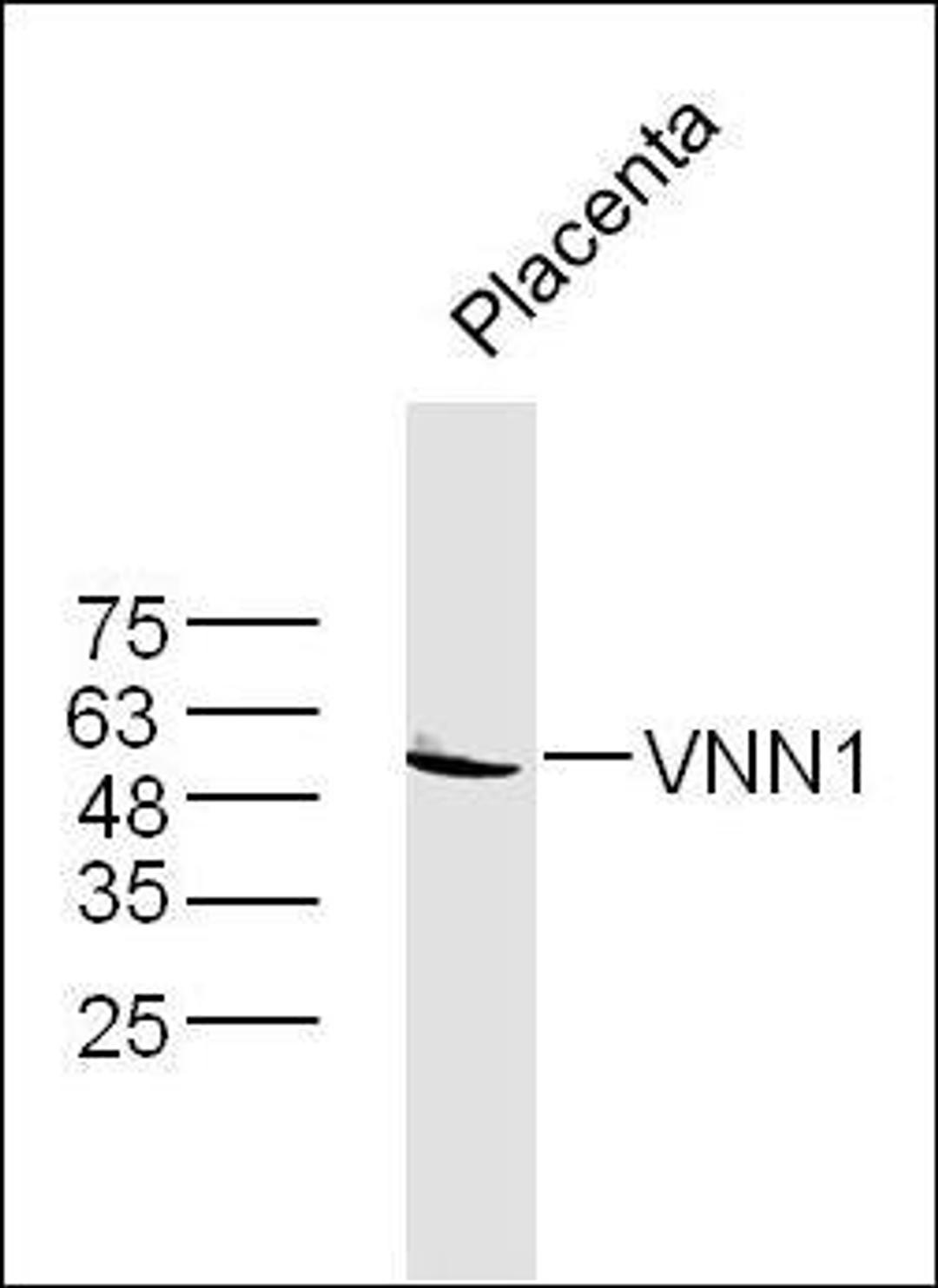 Western blot analysis of extracts from Placenta using VNN1 