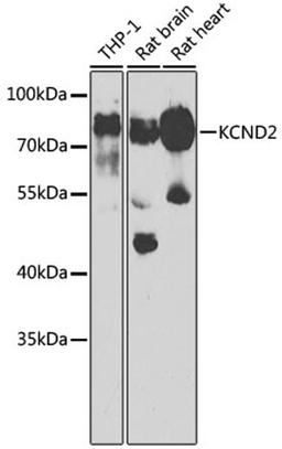 Western blot - KCND2 antibody (A6203)