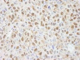 Detection of mouse PPP4C by immunohistochemistry.