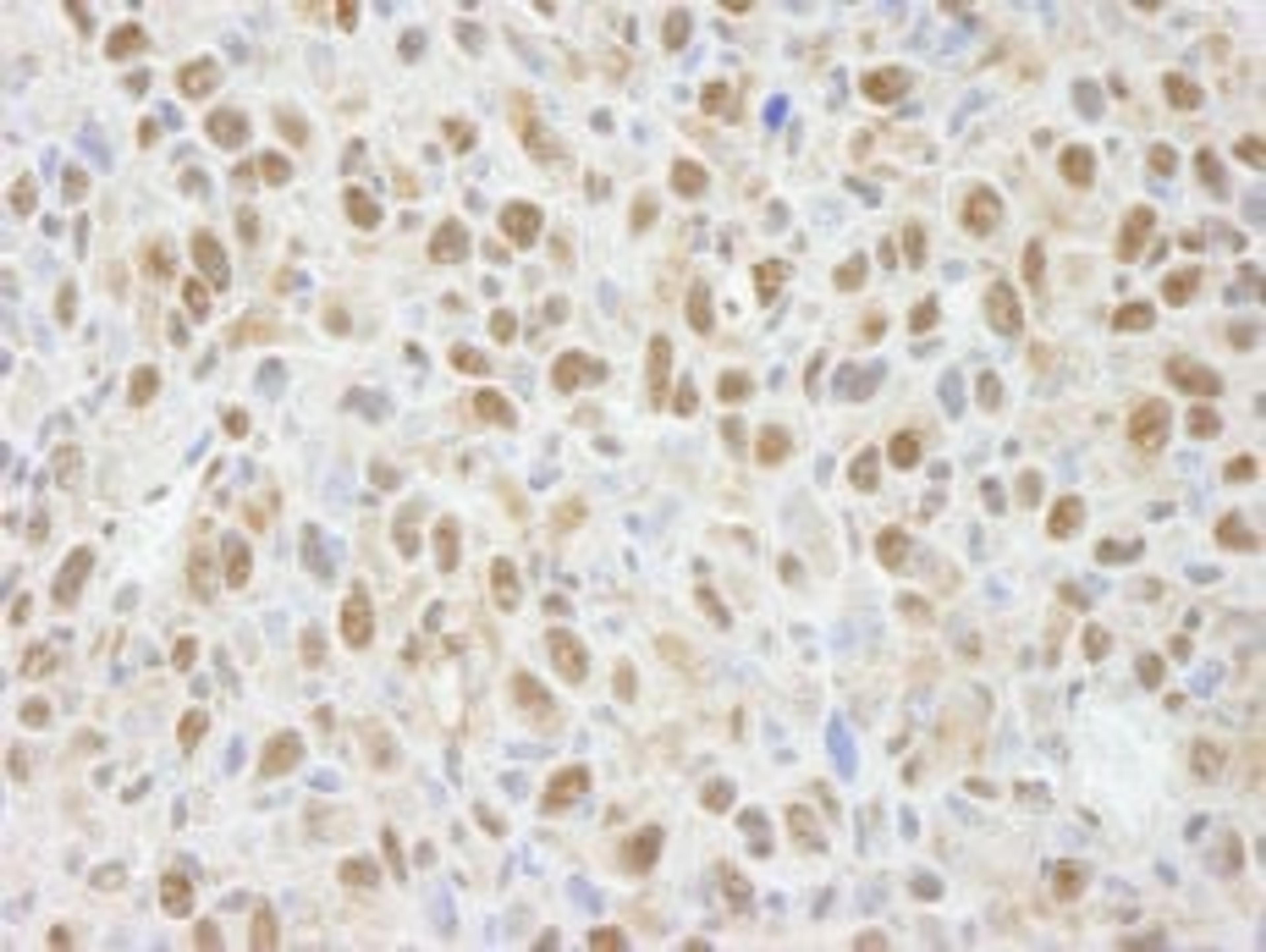 Detection of mouse PPP4C by immunohistochemistry.