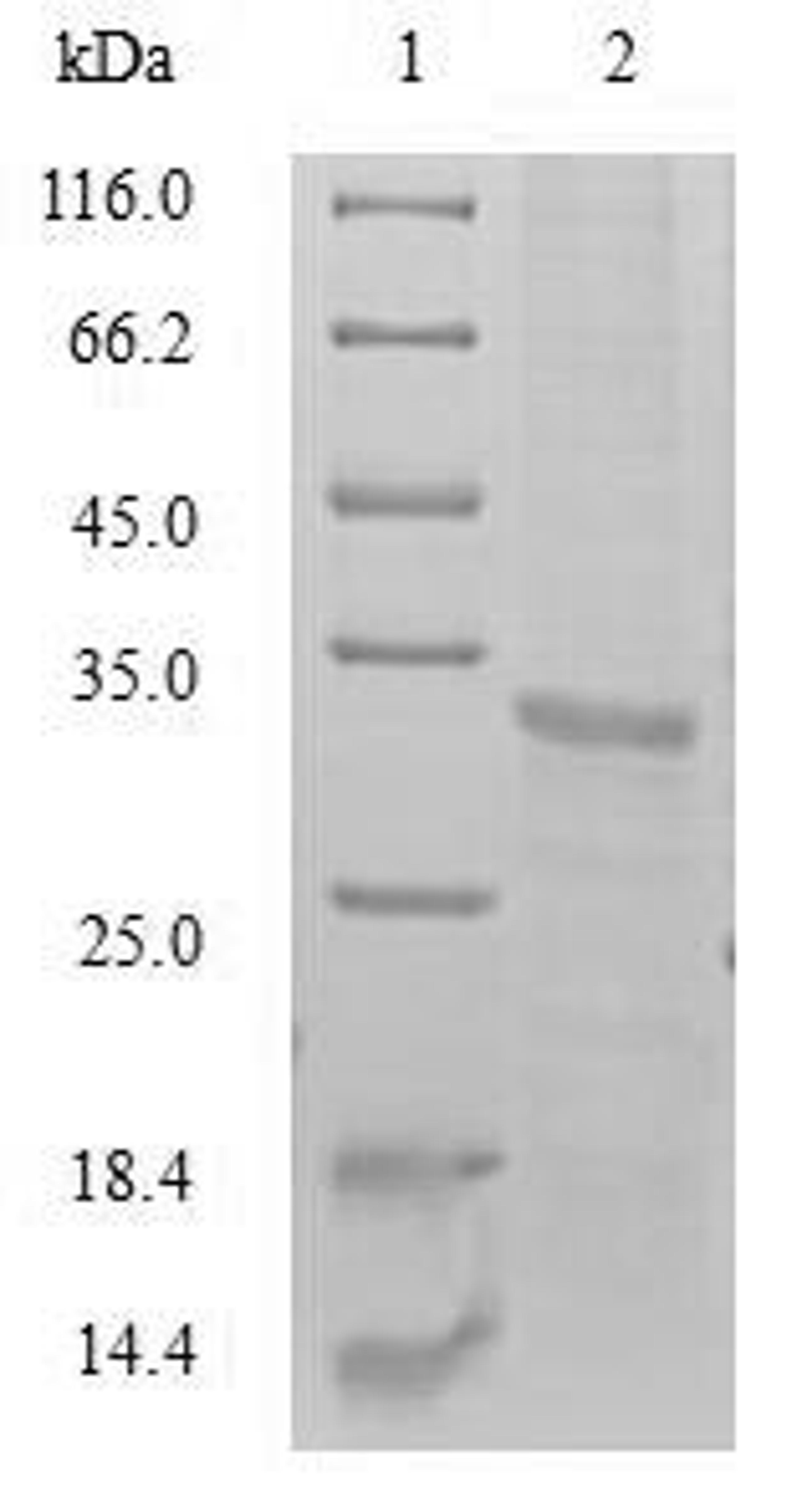 (Tris-Glycine gel) Discontinuous SDS-PAGE (reduced) with 5% enrichment gel and 15% separation gel.