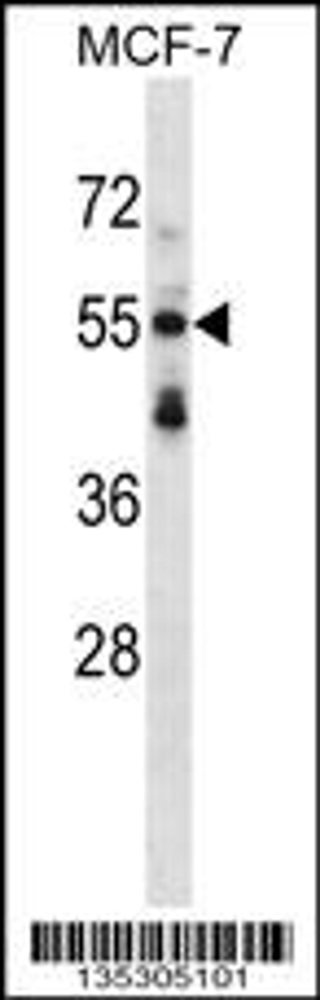 Western blot analysis in MCF-7 cell line lysates (35ug/lane).