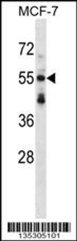 Western blot analysis in MCF-7 cell line lysates (35ug/lane).