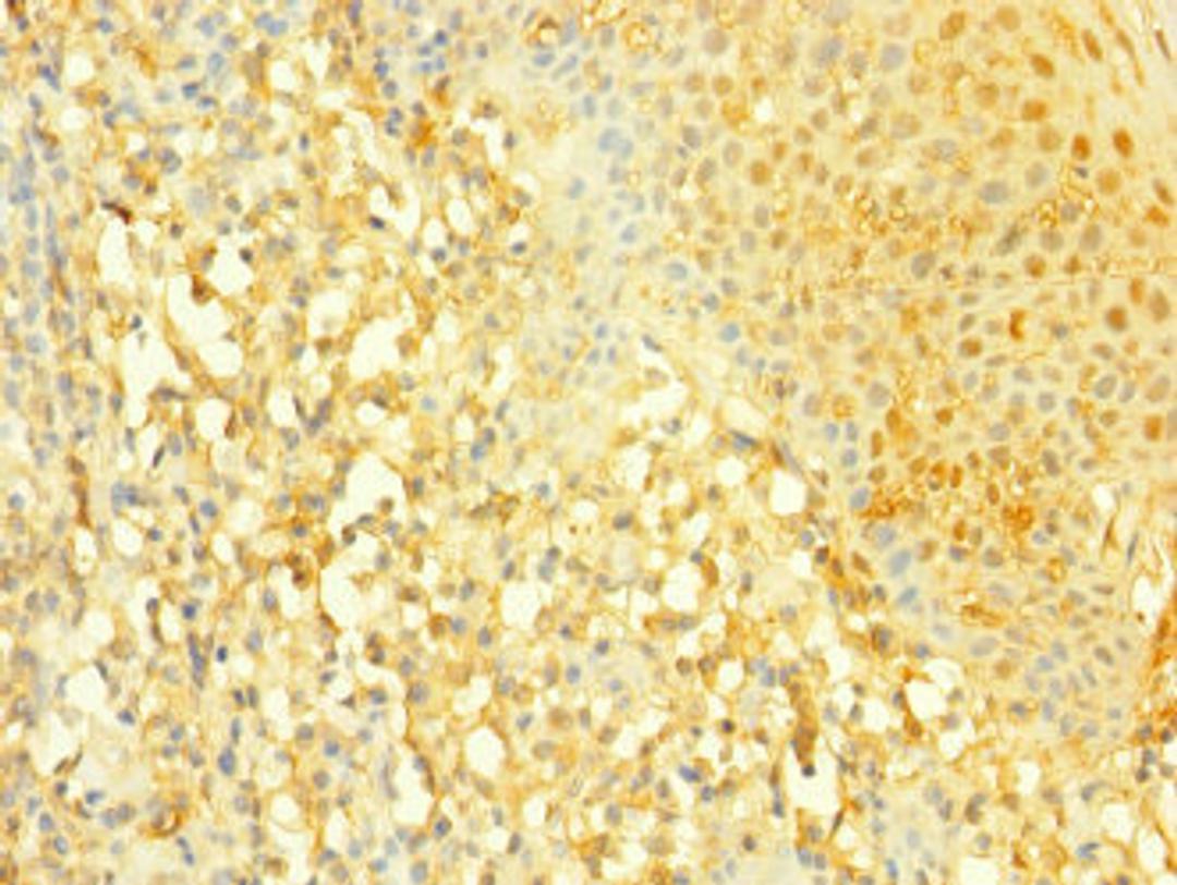 Immunohistochemistry of paraffin-embedded human tonsil tissue using CSB-PA897593DSR2HU at dilution of 1:100