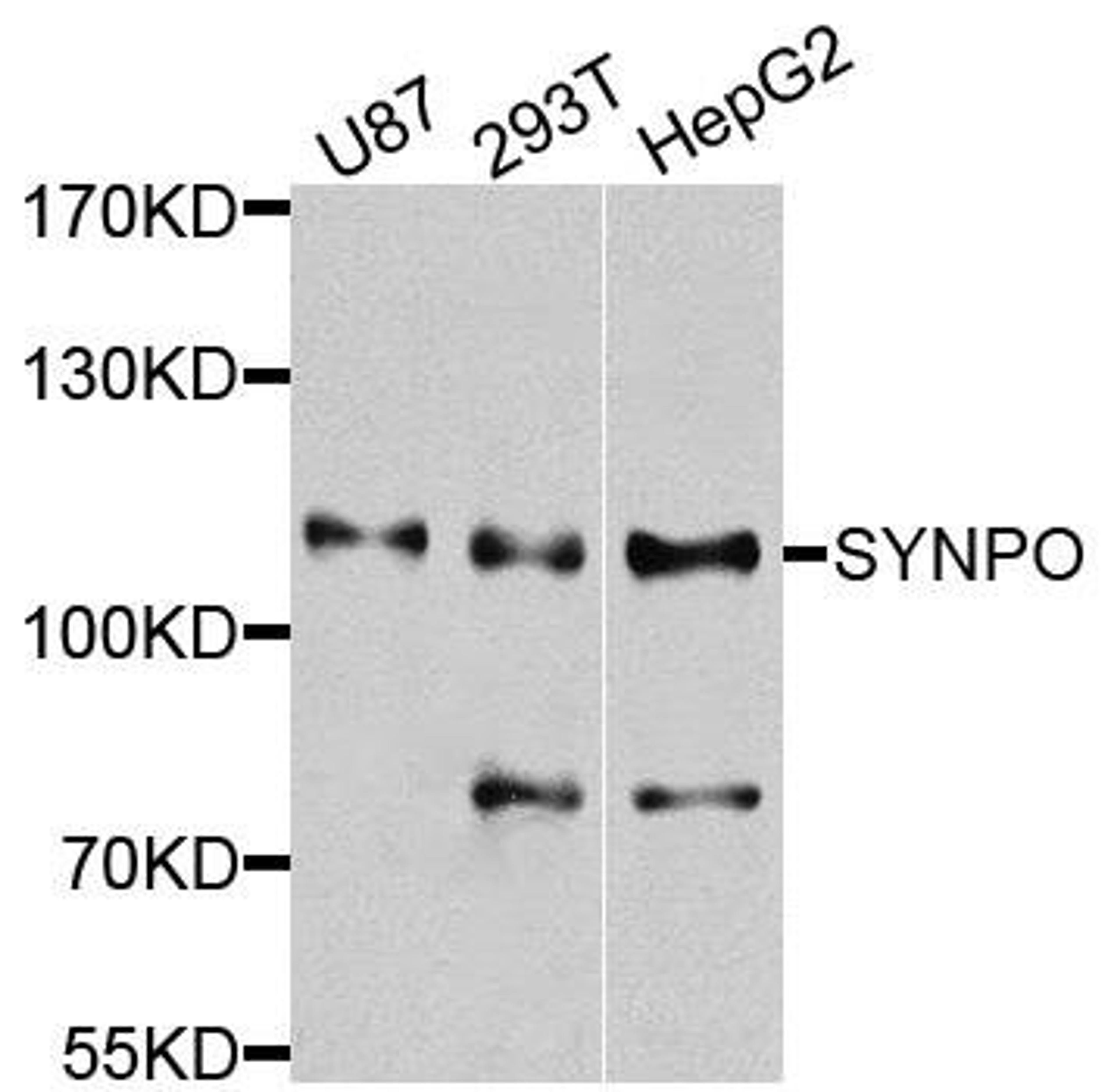 Western blot analysis of extracts of various cells using SYNPO antibody