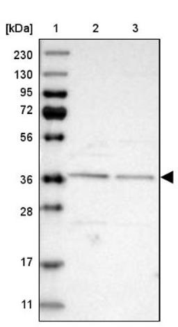 Western Blot: DERP6 Antibody [NBP1-85250] - Lane 1: Marker [kDa] 230, 130, 95, 72, 56, 36, 28, 17, 11<br/>Lane 2: Human cell line RT-4<br/>Lane 3: Human cell line U-251MG sp