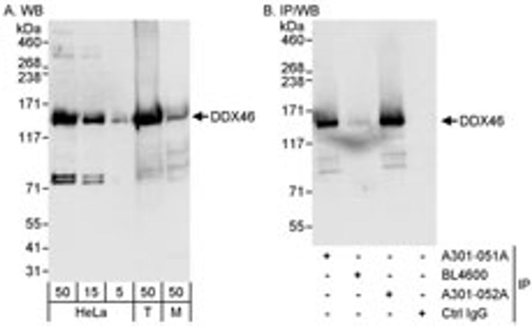 Detection of human and mouse DDX46 by western blot (h&m) and immunoprecipitation (h).