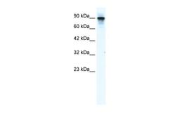 Antibody used in WB on Human Jurkat 1.25 ug/ml.