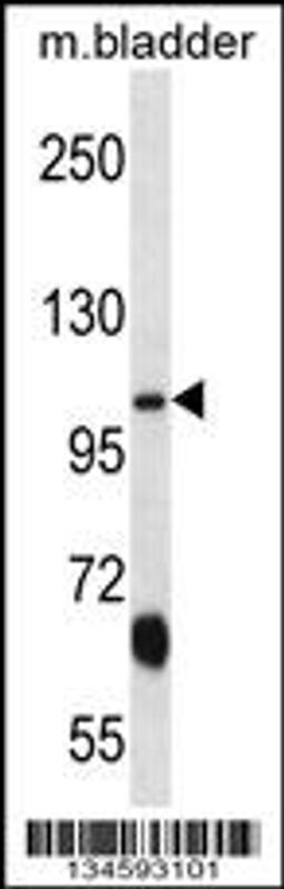 Western blot analysis in mouse bladder tissue lysates (35ug/lane).