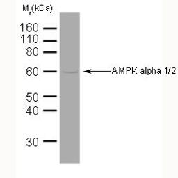 AMPK alpha 1/2 detected in human brain lysate using Mouse anti AMPK alpha 1/2 (MCA2673GA)