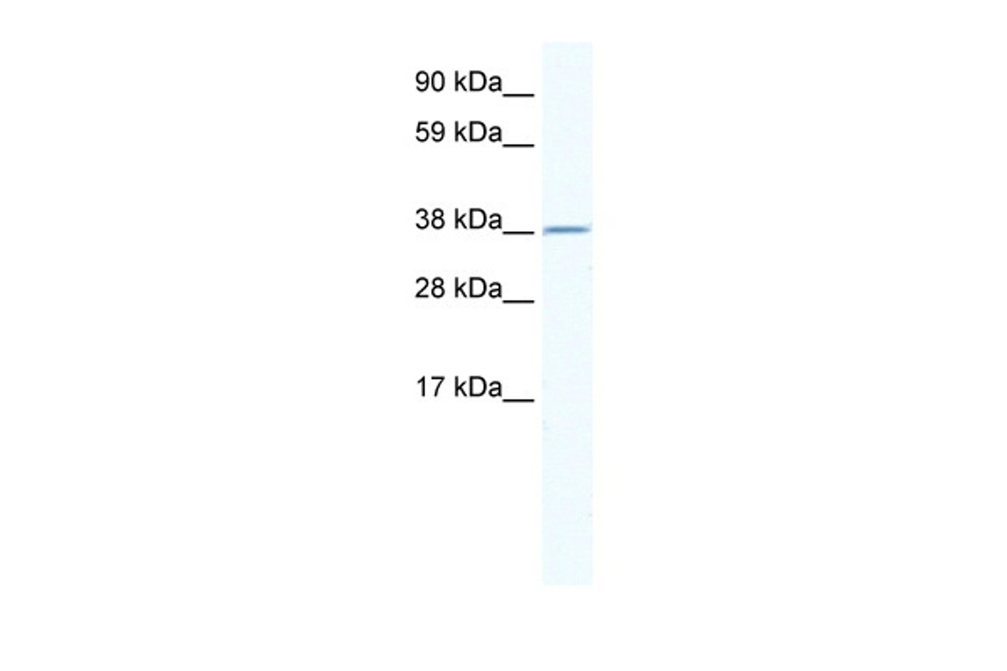 Antibody used in WB on Human Thymus at 2.5 ug/ml.