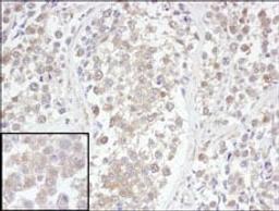 Detection of human UCH-L3 by immunohistochemistry.