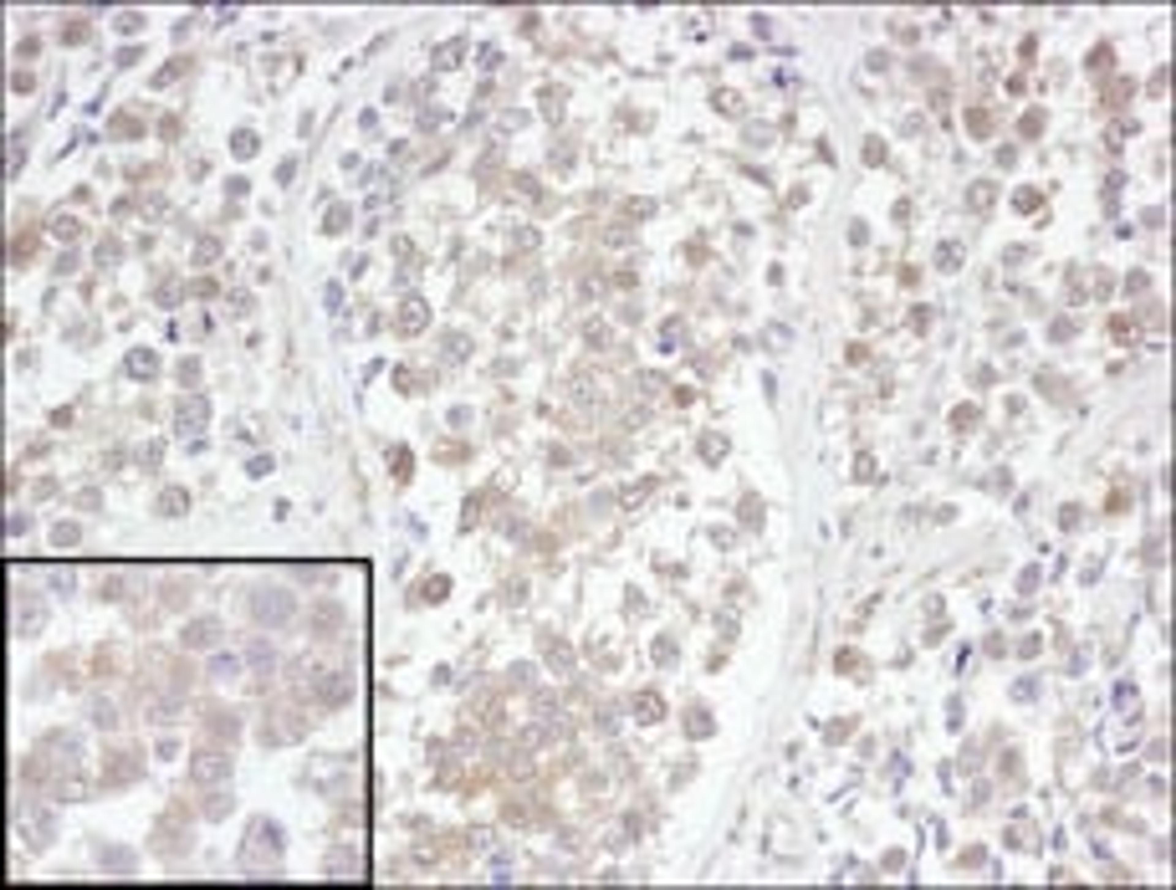 Detection of human UCH-L3 by immunohistochemistry.