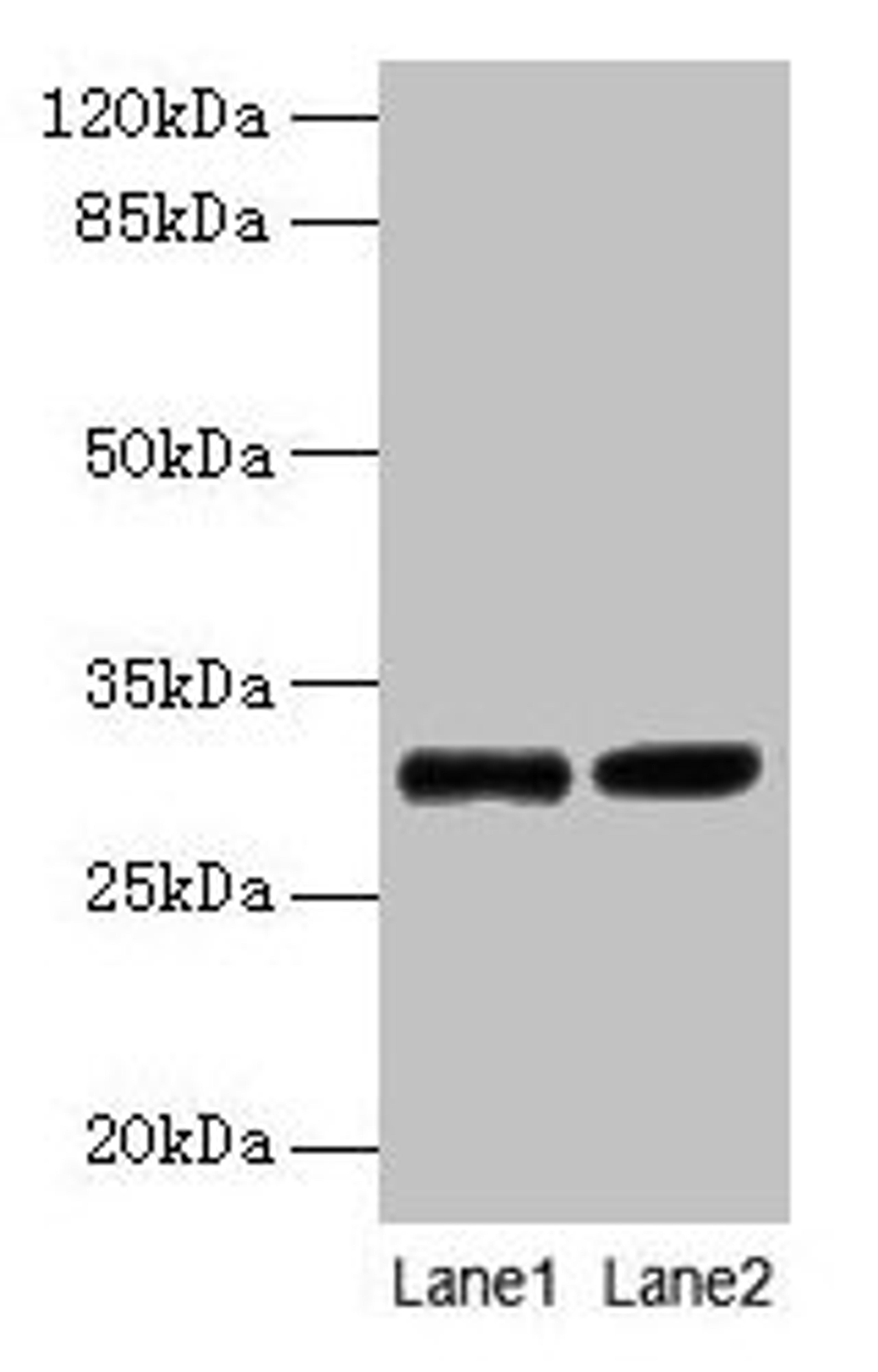 Western blot. All lanes: UQCRQ antibody at 2µg/ml. Lane 1: EC109 whole cell lysate. Lane 2: 293T whole cell lysate. Secondary. Goat polyclonal to rabbit IgG at 1/15000 dilution. Predicted band size: 10 kDa. Observed band size: 30 kDa