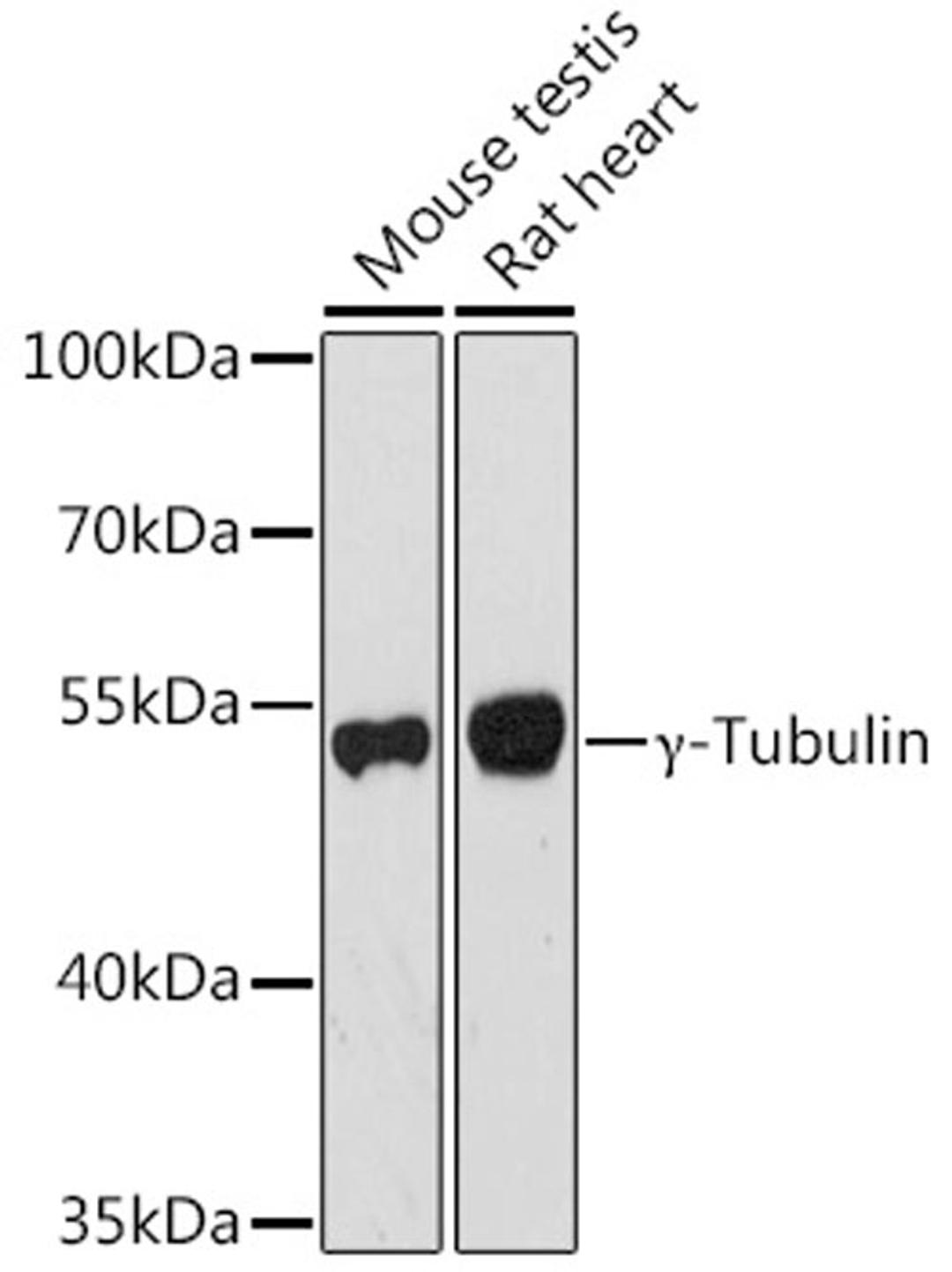 Western blot - ?-Tubulin antibody (A6215)