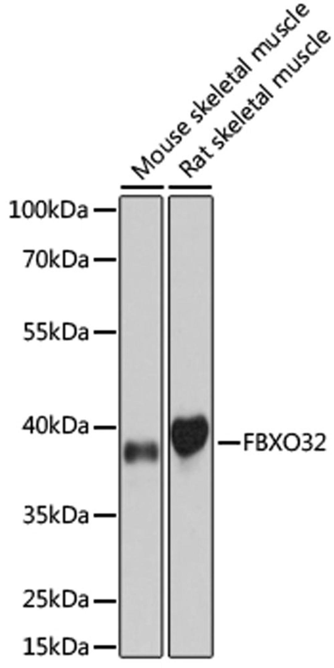 Western blot - FBXO32 antibody (A3193)