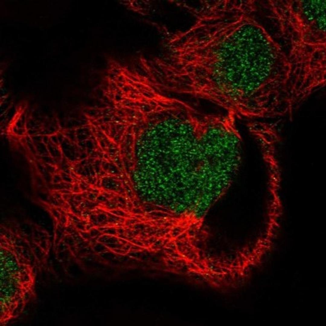 Immunocytochemistry/Immunofluorescence: FLJ46536 Antibody [NBP1-91908] - Staining of human cell line A-431 shows positivity in nucleus but not nucleoli.