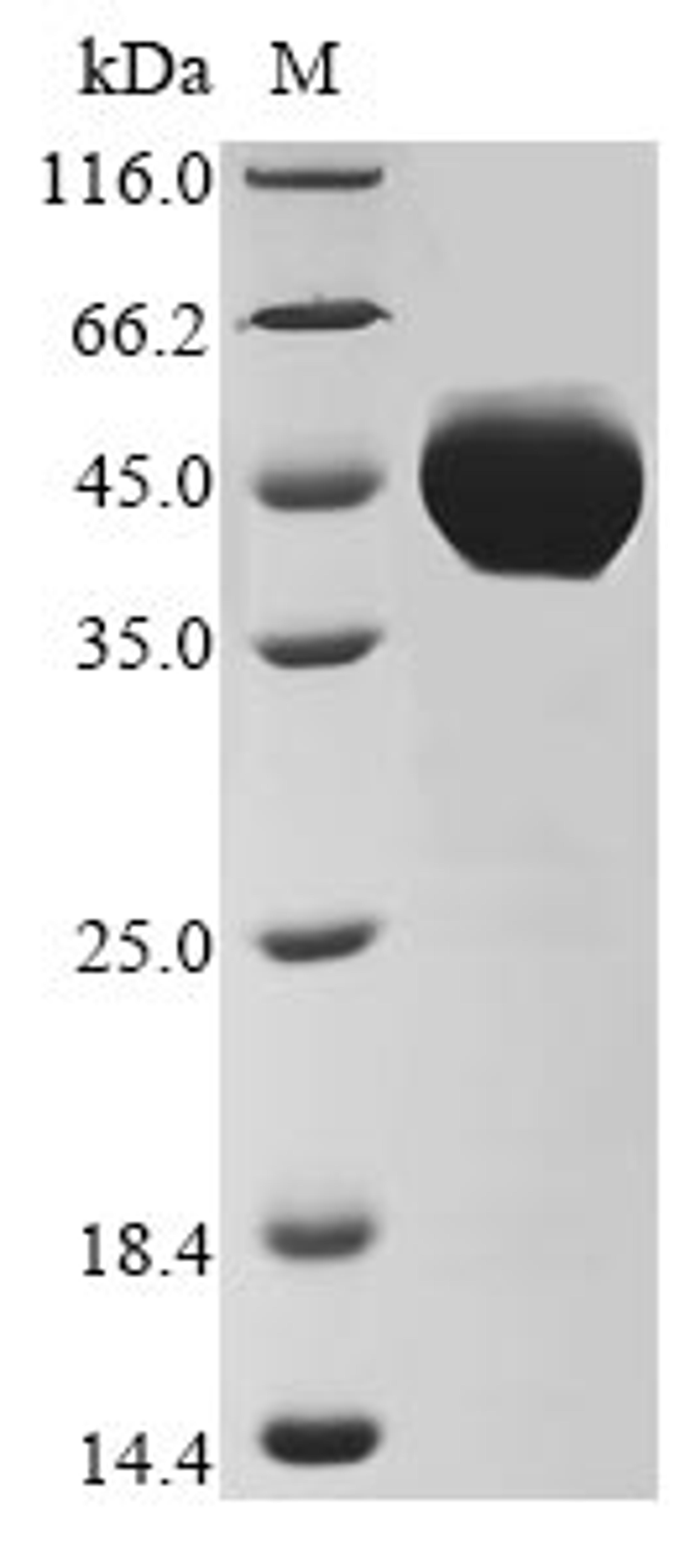 (Tris-Glycine gel) Discontinuous SDS-PAGE (reduced) with 5% enrichment gel and 15% separation gel.