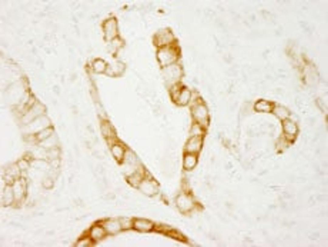 Detection of human PKD2 by immunohistochemistry.