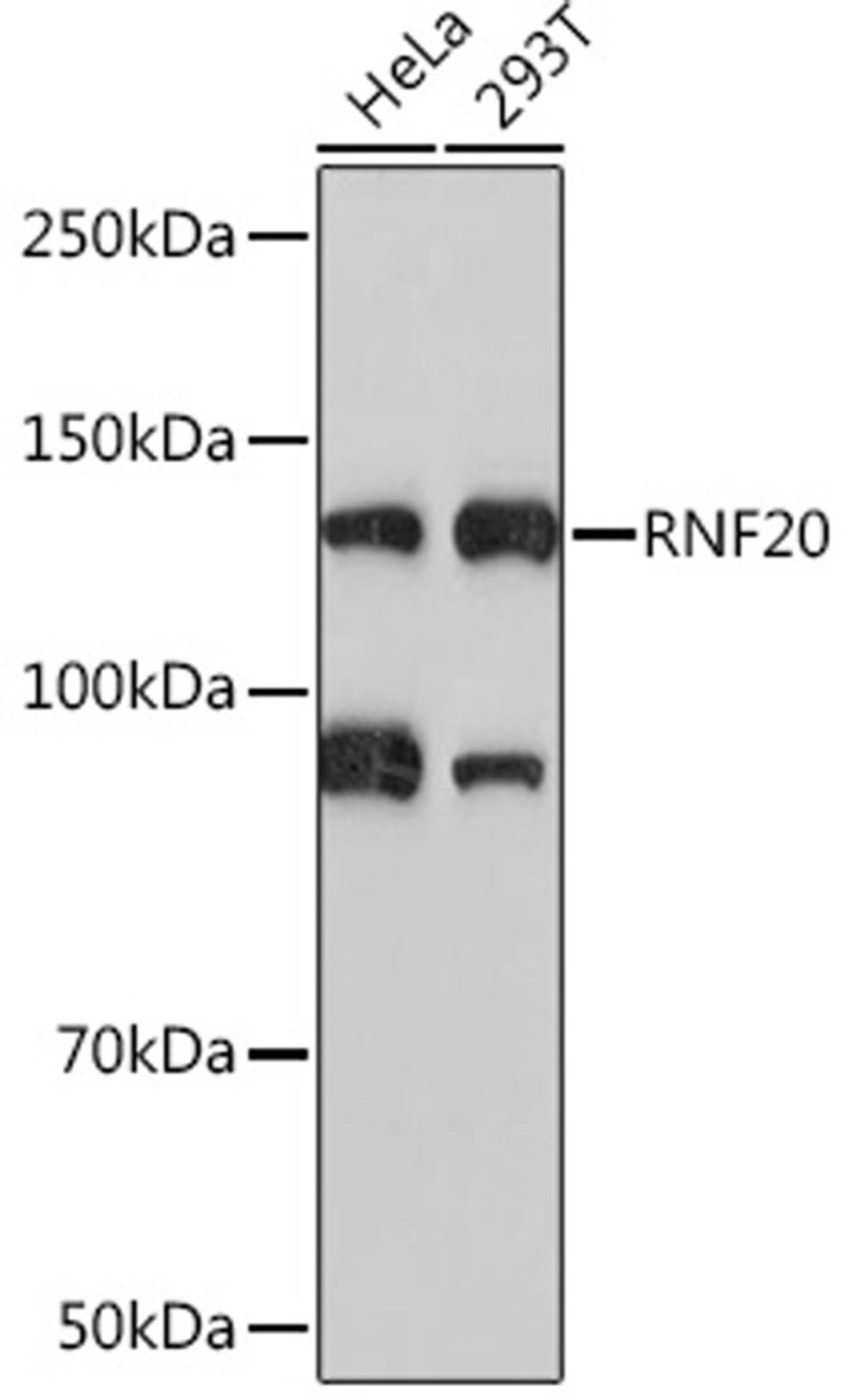 Western blot - RNF20 Rabbit mAb (A4784)