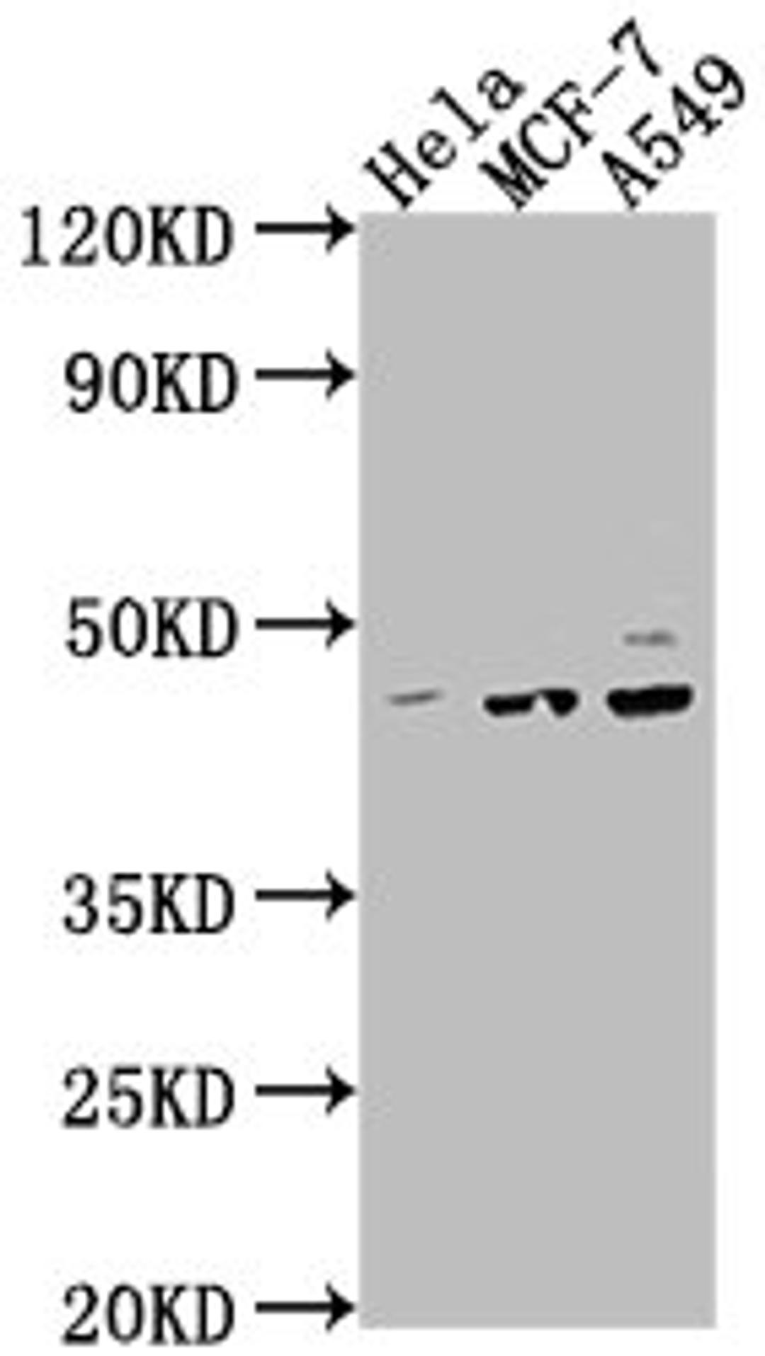 Western Blot. Positive WB detected in: Hela whole cell lysate, MCF-7 whole cell lysate, A549 whole cell lysate. All lanes: PRKACA antibody at 1:2000. Secondary. Goat polyclonal to rabbit IgG at 1/50000 dilution. Predicted band size: 41, 40 kDa. Observed band size: 41 kDa.
