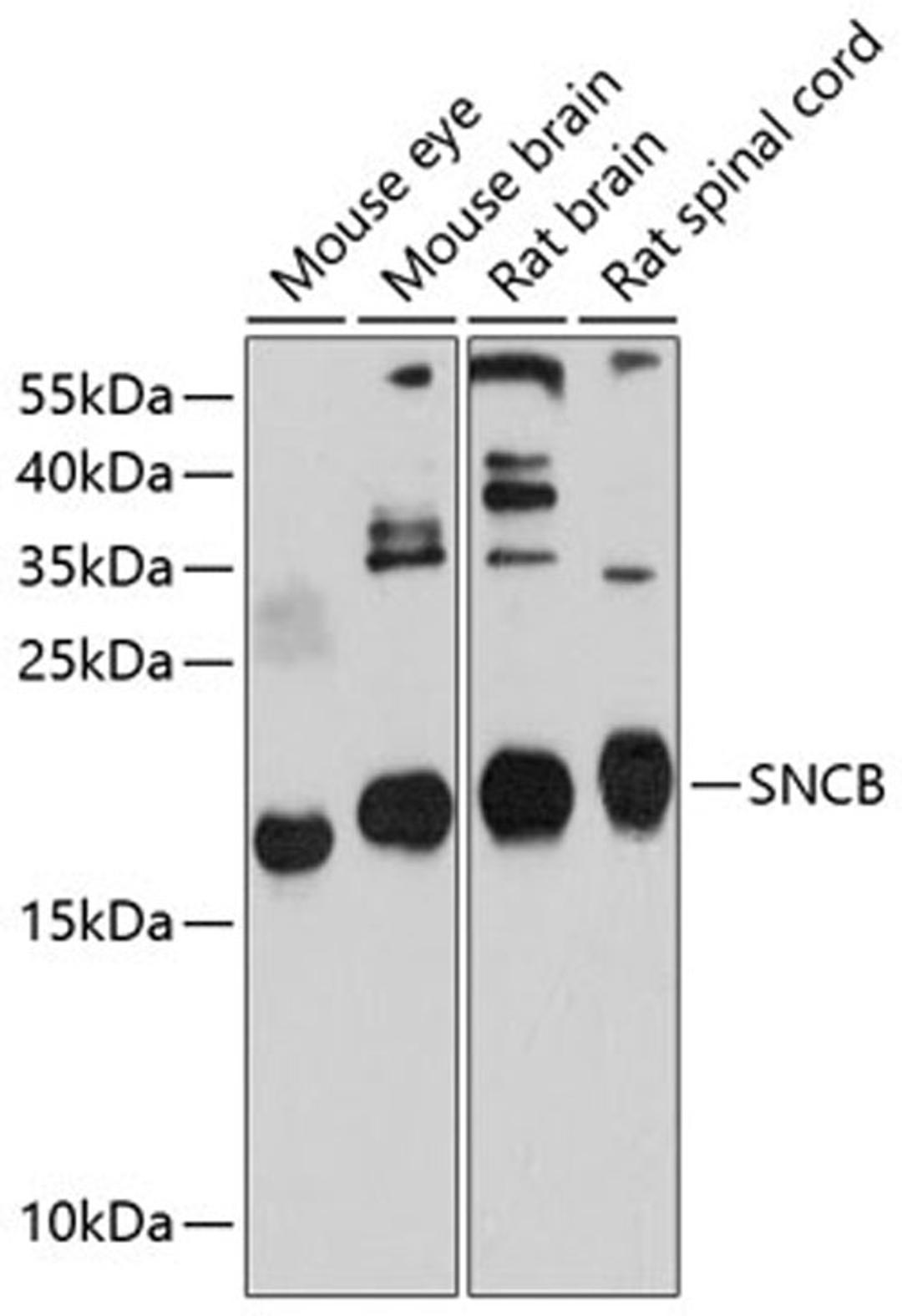 Western blot - SNCB antibody (A10443)