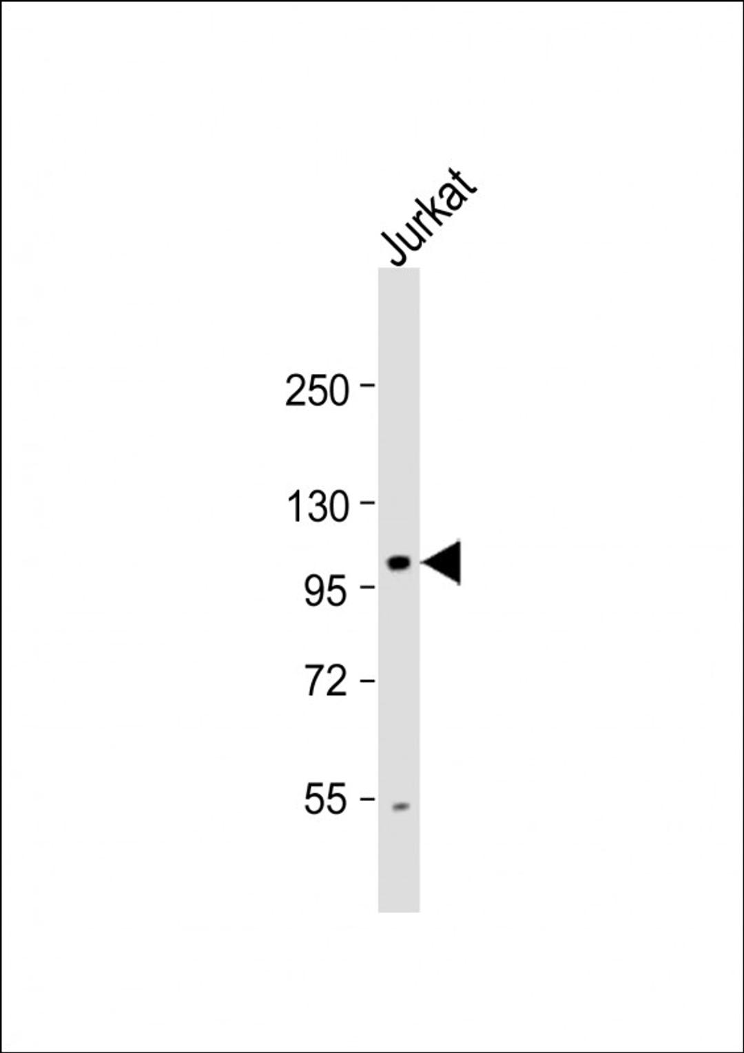 Western Blot at 1:1000 dilution + Jurkat whole cell lysate Lysates/proteins at 20 ug per lane.