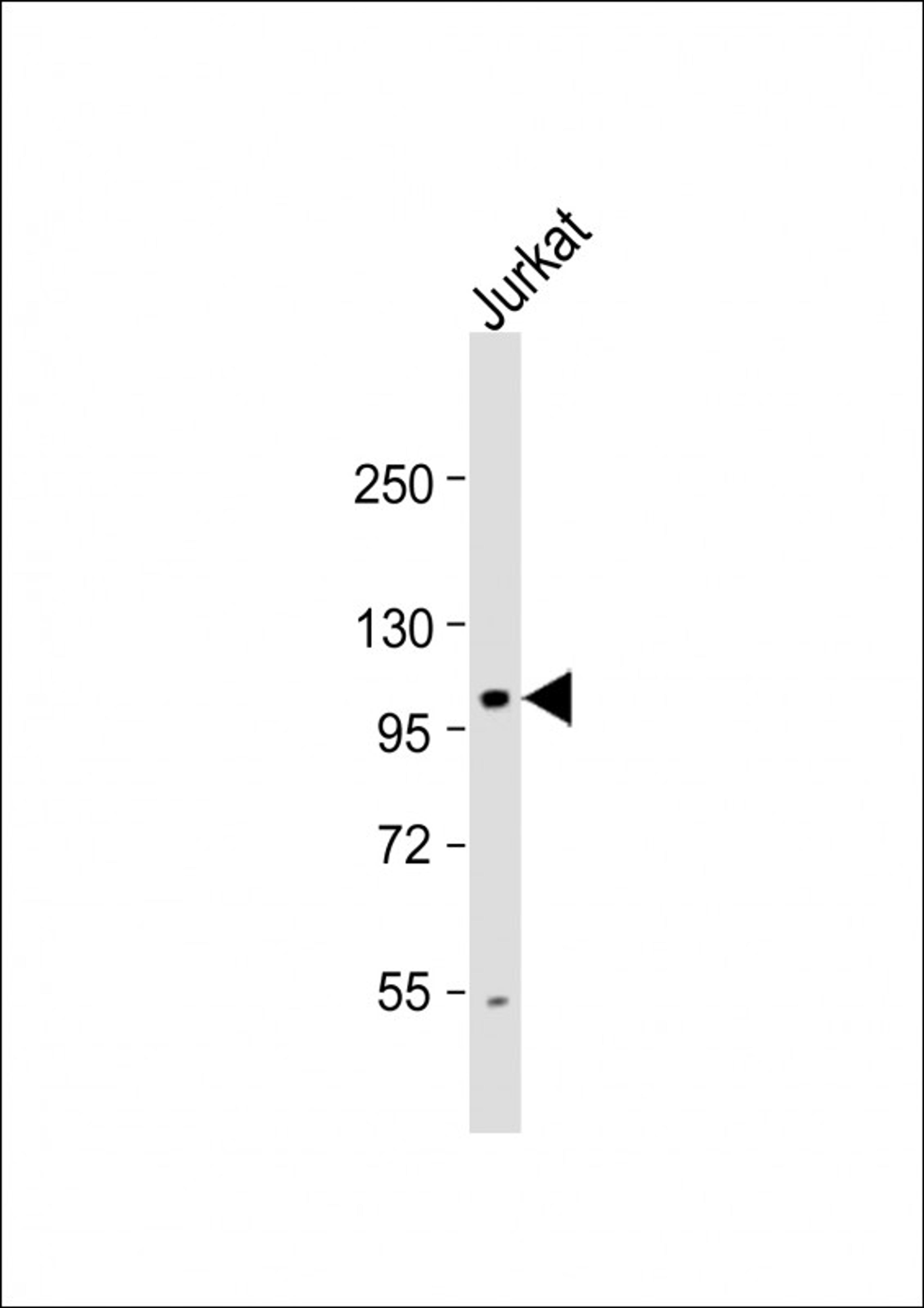 Western Blot at 1:1000 dilution + Jurkat whole cell lysate Lysates/proteins at 20 ug per lane.